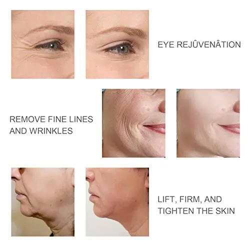 LEFAY Face Skin Tightening Machine - RF Radio Frequency Facial Device Massager Lifting Firming Skin Care Tool for Eyes Neck Wrinkles, Beauty Products